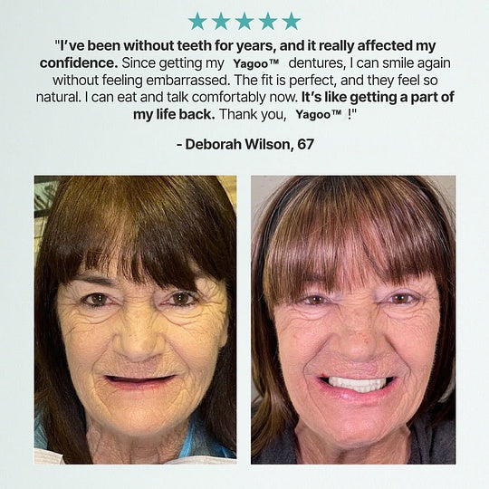 🔥LAST DAY 70% OFF -🏆ENOSINY™ Custom Custom-Fit Full Functional DenturesMake you more confident – Made in the USA & FDA-Certified