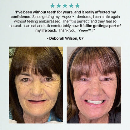 🔥LAST DAY 70% OFF -🏆ENOSINY™ Custom Custom-Fit Full Functional DenturesMake you more confident – Made in the USA & FDA-Certified